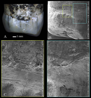 Tooth-picking Behavior Identified in the Middle Pleistocene Hominins of Eastern China