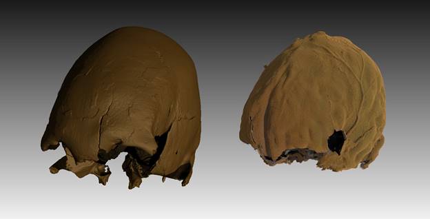 11,000 Year Old Social Complexity Shown by the Oldest Known Intentionally Deformed Skull from Eurasia